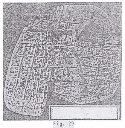 Fig.
                                29: H�gado humano en un modelo de
                                arcilla