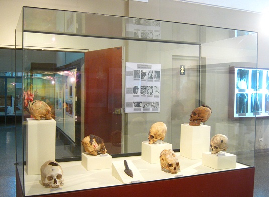 Showcase with drilled skulls,
                              close-up
