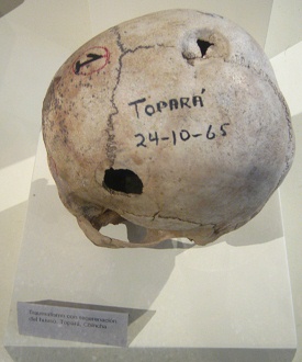 Drilled skull 06, second photo
