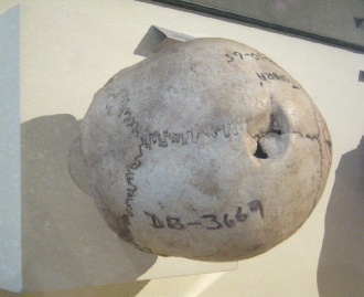 Drilled skull 06, third photo