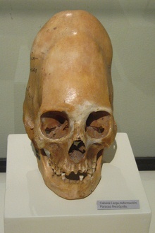 Deformed skull of Paracas
                                    culture (long skull) 03