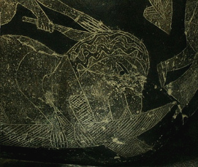 The surgeon
                                  cutting the skull